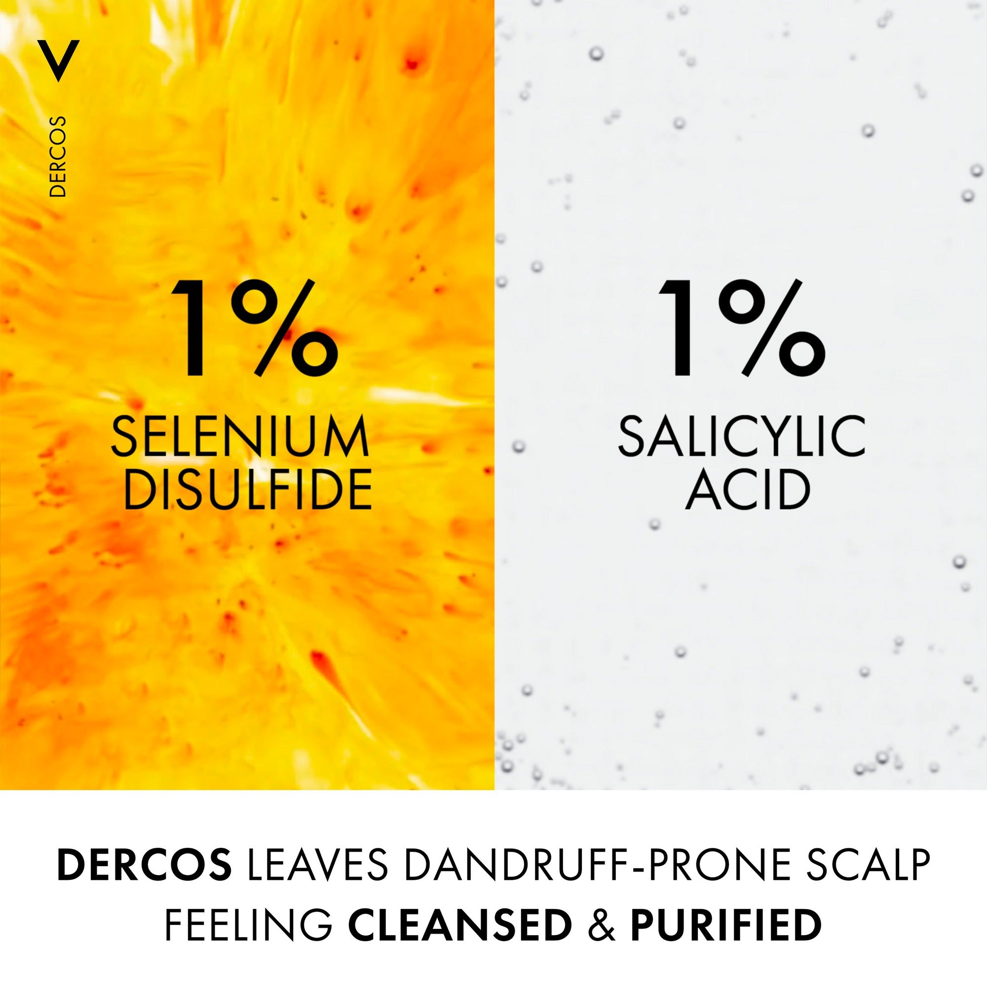 Vichy Dercos Anti-Dandruff Shampoo Dry Hair 200ml