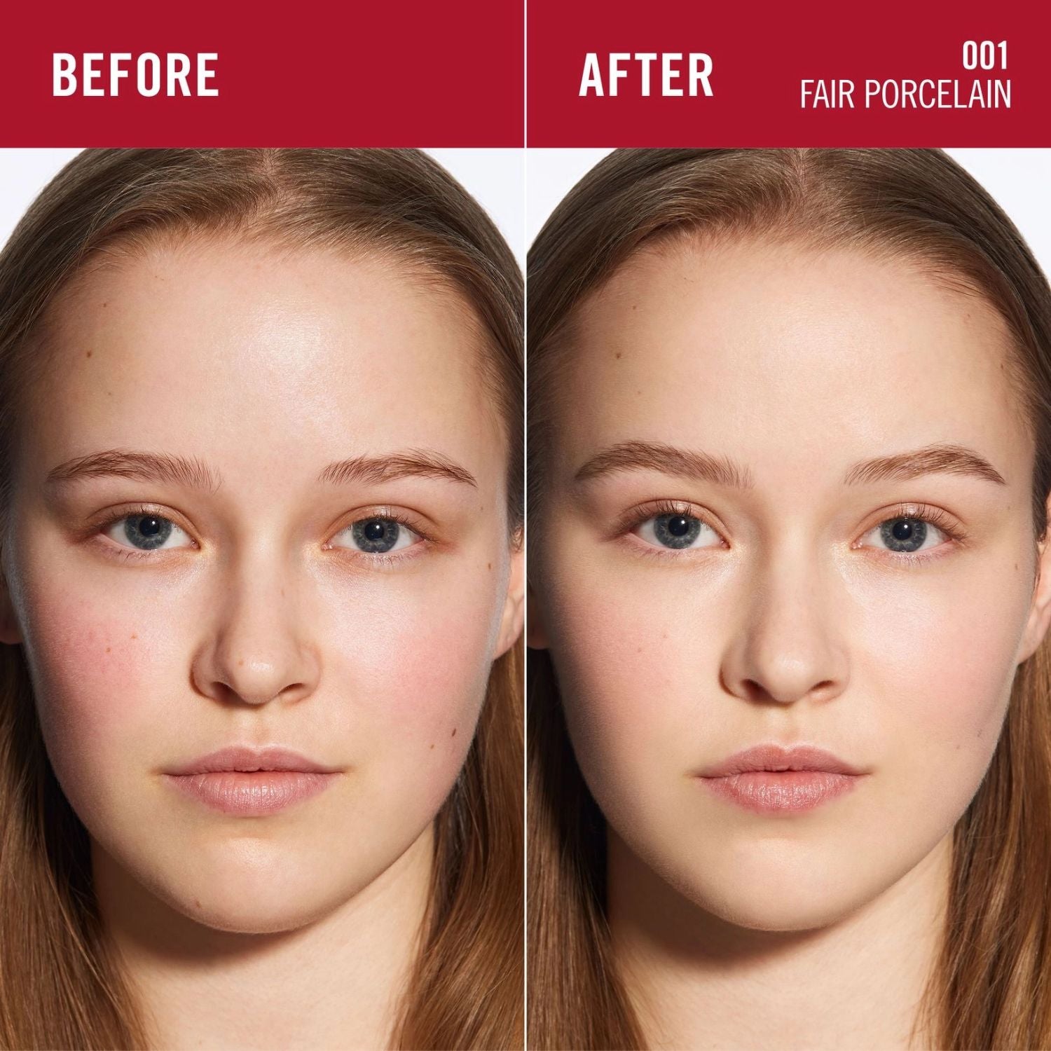 Before and after comparison of a woman&