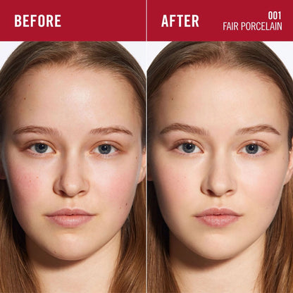 Before and after comparison of a woman&