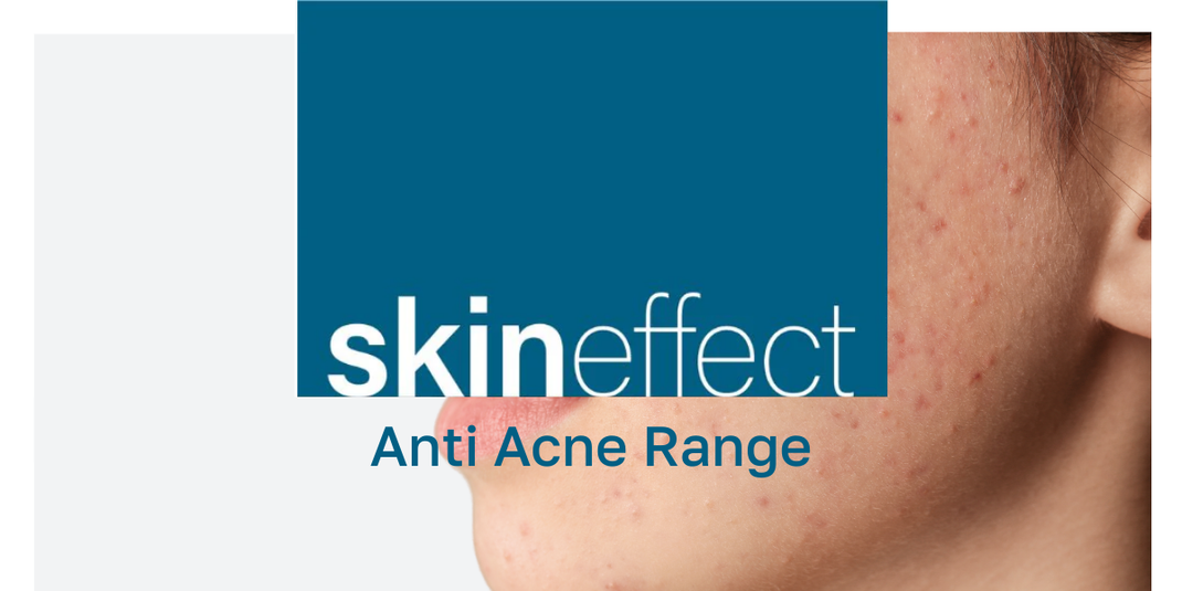 Skineffects Anti Acne Range