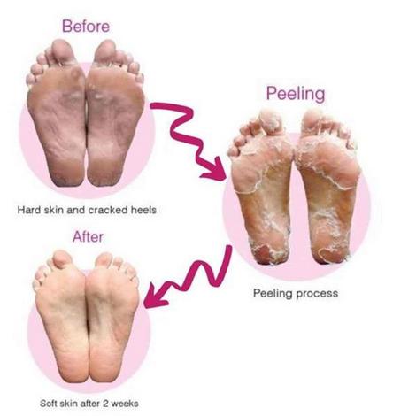 Bathefex SoftSole Express Exfoliating Foot Peel Renew Your Feet