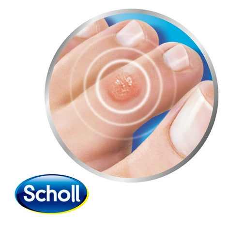 Dr. Scholl's Ingrown Toenail Pain Reliever : Amazon.in: Health & Personal  Care